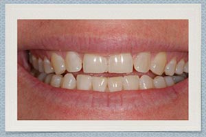 The Art of a Beautiful Smile Dental CE Video Course by George Kirtley, DDS