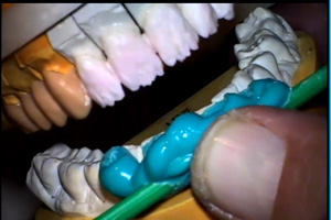 Building the Bridge from Dentist to Ceramist: Why Communication Matters Part II Dental CE Video Course by Tom Trinkner, DDS,Matt Roberts, CDT